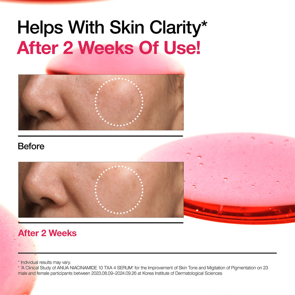 Anua Niacinamide 10% + TXA 4% Serum 30ml results after use