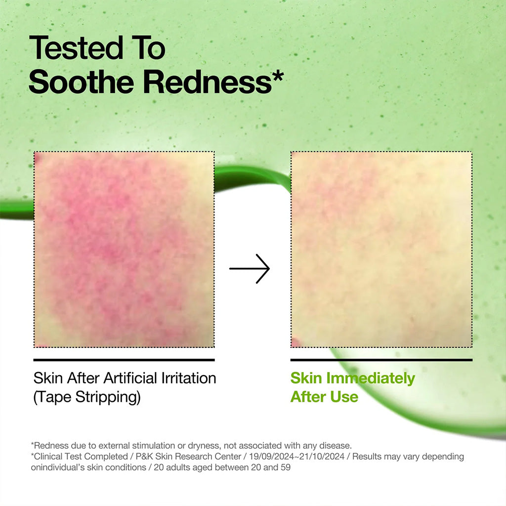 Anua Azelaic Acid 10 Hyaluron Redness Soothing Serum 30ml results