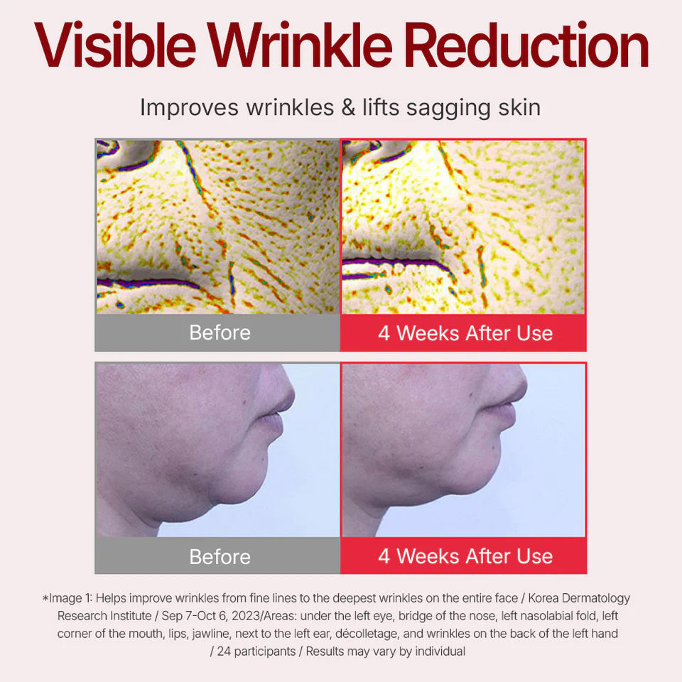 Centellian24 Madeca Cream Time Reverse 50ml - visible wrinkle reduction before and after results