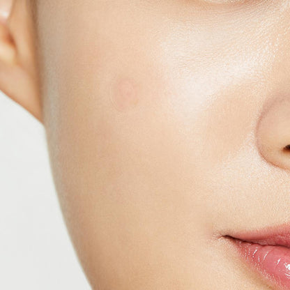 COSRX Clear Fit Master Patch | Korean Skincare Acne Treatment NZ AU - Bini Beauty