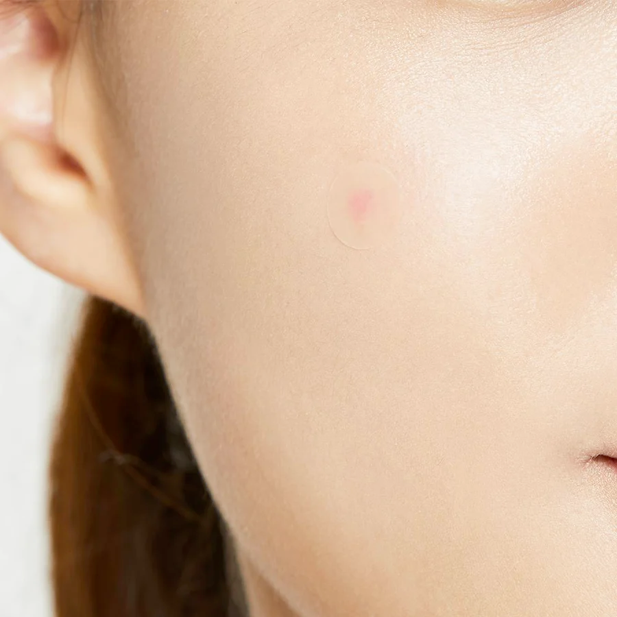 COSRX Acne Pimple Master Patch | Korean Skincare Acne Treatment NZ AU - in use