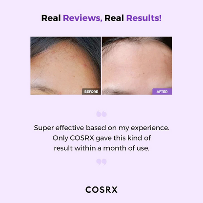 COSRX AHA/BHA Clarifying Treatment Toner 150mL | Korean Skincare NZ AU - results