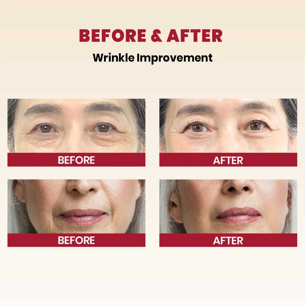 Before and after use of K-SECRET SEOUL 1988 Cream : Retinal Liposome 1% + Fermented Rice 50ml