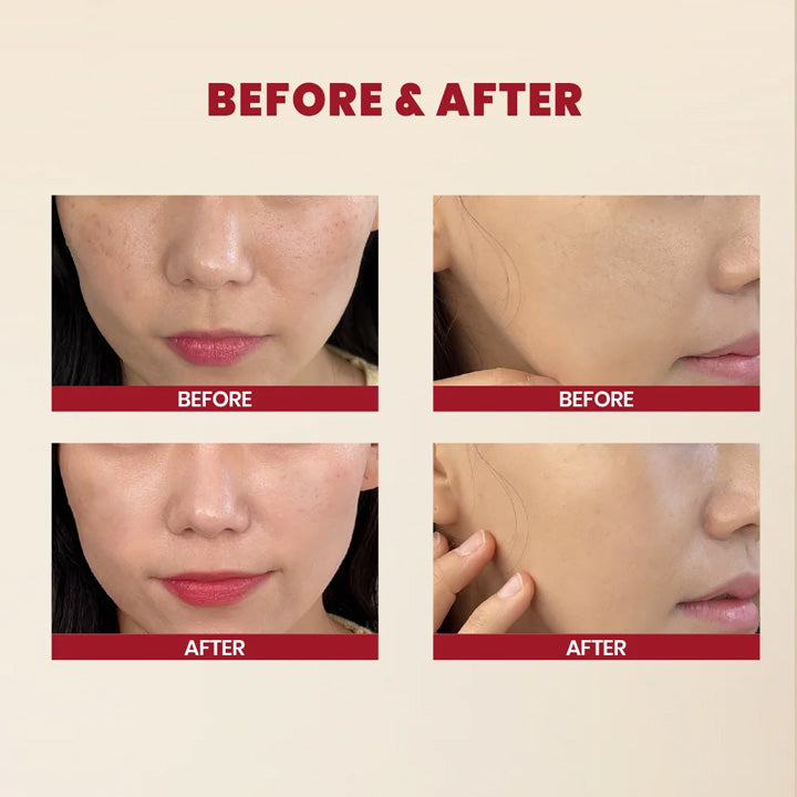 Before and After use of K-SECRET SEOUL 1988 Essence : Snail Mucin 97% + Rice 100ml