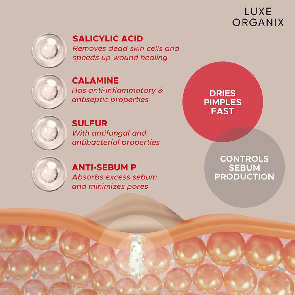 Luxe Organix 2-in-1 Acne Rescue Mud Powder Overnight Pimple Drying 9g