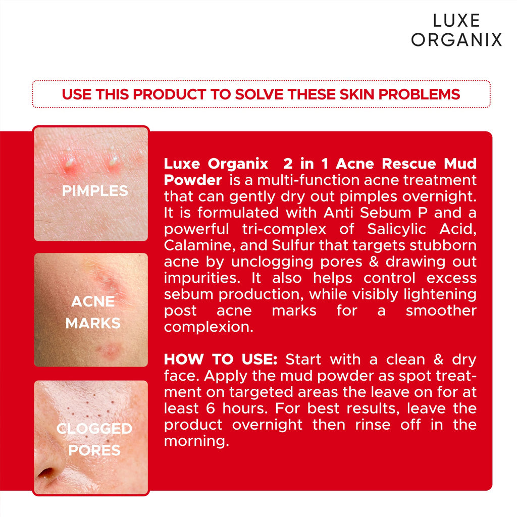 Luxe Organix 2-in-1 Acne Rescue Mud Powder Overnight Pimple Drying 9g
