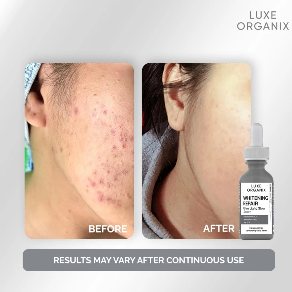 Luxe Organix Whitening Repair Ultra Light Glow Serum | Bini Beauty